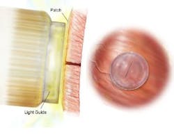 Content Dam Bow Online Articles 2014 01 Heart Adhesive 1 Web Content Dam Bow Online Articles 2014 01 Heart Adhesive 1 Web