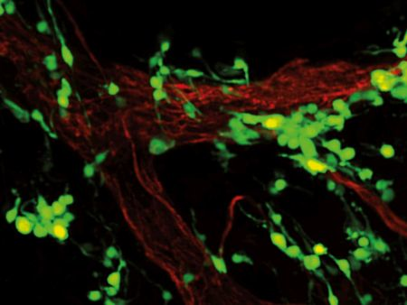 Content Dam Bow Online Articles 2014 03 T Ting Neuest Melanomzellen Web