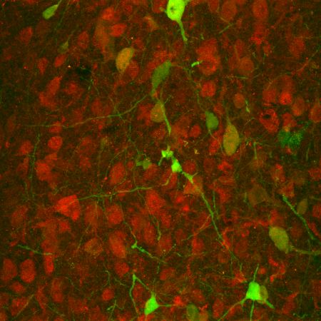 Content Dam Bow Online Articles 2014 04 Masseck Serotoninrezeptoren C Masseck Web