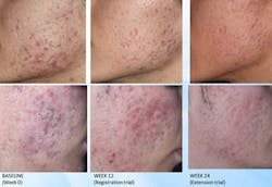 Content Dam Bow Online Articles 2014 07 Klox Tech Content Dam Bow Online Articles 2014 07 Klox Tech