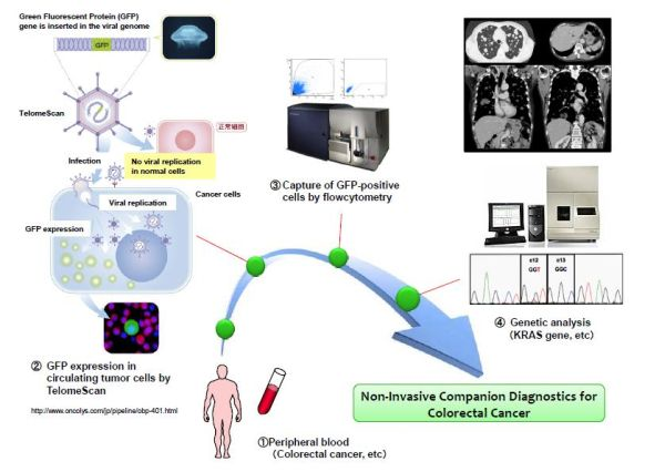 Content Dam Bow Online Articles 2014 07 Liquid Biopsy Web