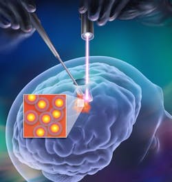 Content Dam Bow Online Articles 2014 09 Braintumorhr Web Content Dam Bow Online Articles 2014 09 Braintumorhr Web