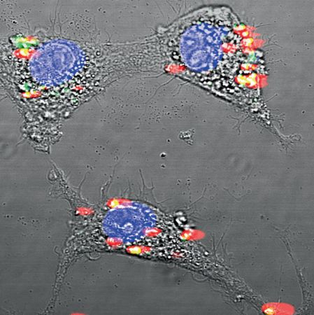 Content Dam Bow Online Articles 2014 10 Albumin Encapsulated Re Web