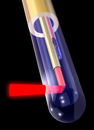 Content Dam Bow Online Articles 2014 10 Neuroblate 2