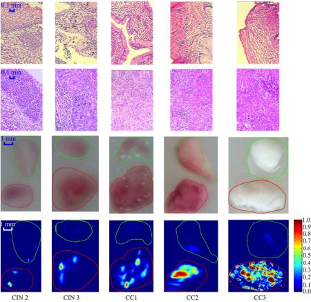 Content Dam Bow Online Articles 2014 12 Boex Photoacoustic Web