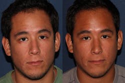 Content Dam Bow Online Articles 2014 12 Fractional Content Dam Bow Online Articles 2014 12 Fractional