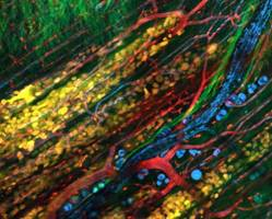 The collective invasion of tumor cells (yellow) in the skin of a mouse. The cells follow the path of the nerves and adipose tissue (blue), connective tissue and muscles (green), and blood vessels (red).