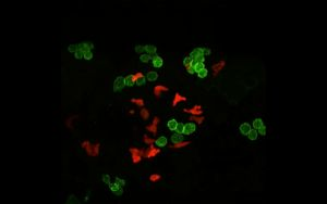 Content Dam Bow Online Articles 2015 July Woundhealingcancer