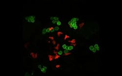 Content Dam Bow Online Articles 2015 July Woundhealingcancer Content Dam Bow Online Articles 2015 July Woundhealingcancer