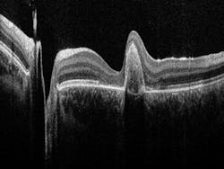 Content Dam Bow Online Articles 2015 June Oct Image Retina 72dpi 02 4337625e9c Content Dam Bow Online Articles 2015 June Oct Image Retina 72dpi 02 4337625e9c