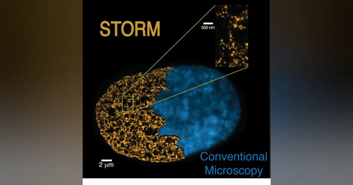 Super-resolution microscopy visualizes the genome at the nanoscale ...