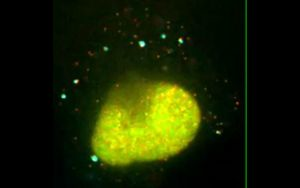 Content Dam Bow Online Articles 2015 March Mrna Thumb