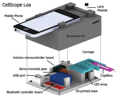 Content Dam Bow Online Articles 2015 May Cellscopeloa Schematic400