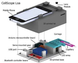 Content Dam Bow Online Articles 2015 May Cellscopeloa Schematic400 Content Dam Bow Online Articles 2015 May Cellscopeloa Schematic400