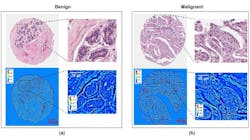 Content Dam Bow Online Articles 2015 November Opticalimaging Web Content Dam Bow Online Articles 2015 November Opticalimaging Web