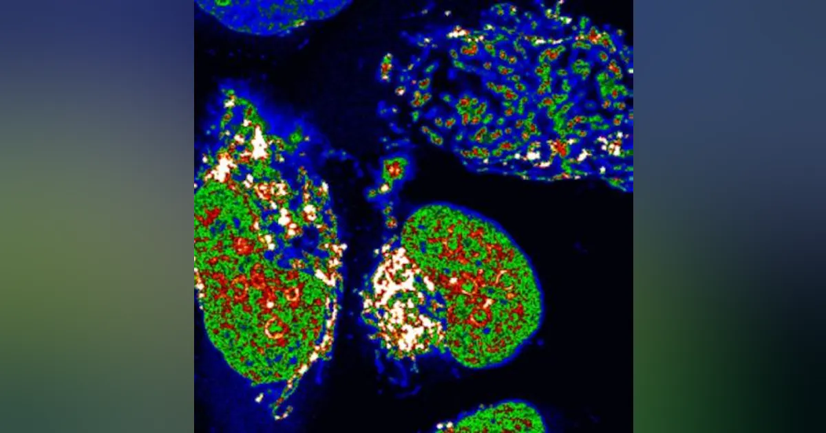 Confocal microscopy helps reveal presence of four-stranded DNA in ...