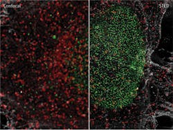 FIGURE 1. A comparison of standard confocal microscopy with super-resolved fluorescence in the form of stimulated emission depletion (STED). Here, HeLa cells are shown stained with NUP153-Alexa 532 (green), Clathrin-TMR (red), and Actin-Alexa 488 (white). FIGURE 1. A comparison of standard confocal microscopy with super-resolved fluorescence in the form of stimulated emission depletion (STED). Here, HeLa cells are shown stained with NUP153-Alexa 532 (green), Clathrin-TMR (red), and Actin-Alexa 488 (white).