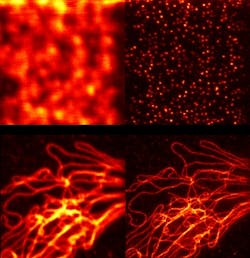 Confocal microscopy (left) is compared with STED microscopy using a Mobius Photonics laser source (right) for two different cases. In both instances, STED results in a far higher resolution.