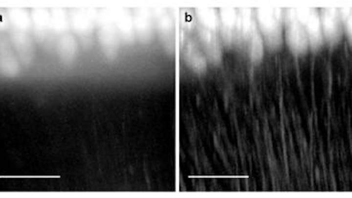 Confocal light-sheet microscopy is sharper way to view the brain's neural network