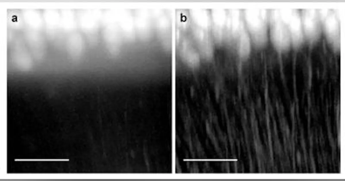 Confocal light-sheet microscopy is sharper way to view the brain's ...