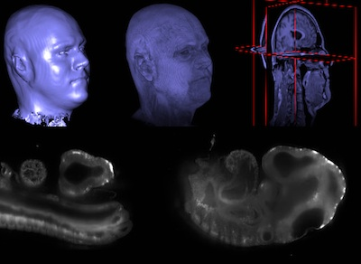 Content Dam Lfw Online Articles 2012 08 Open Source Biomed
