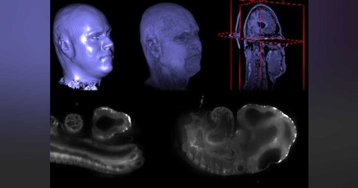 Open-source platform advances biomedical-image processing | Laser Focus ...