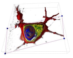 Holographic microscopy combined with computational imaging can see cells in three dimensions without contrast agents. The image can be virtually sliced to expose its internal elements, such as the nucleus, genetic material, and organelles. (Courtesy EPFL) Holographic microscopy combined with computational imaging can see cells in three dimensions without contrast agents. The image can be virtually sliced to expose its internal elements, such as the nucleus, genetic material, and organelles. (Courtesy EPFL)