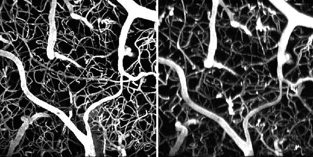 The same section of a mouse brain imaged with a femtosecond laser (left) and with a much weaker laser but using the new nanoparticle dye (right).
