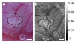 Webcam-based hospital-grade laser-speckle blood-flow imager is low in cost Webcam-based hospital-grade laser-speckle blood-flow imager is low in cost