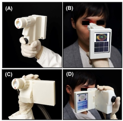 Handheld MEMS-based OCT retinal scanner catches all info in one measurement