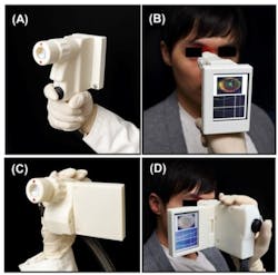 Handheld MEMS-based OCT retinal scanner catches all info in one measurement Handheld MEMS-based OCT retinal scanner catches all info in one measurement