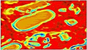 An image of prostate tissue is shown in the mid-infrared region as an example of activities within the MINERVA project led by Gooch and Housego (G&H; Ilminster, England).