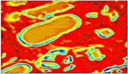 An image of prostate tissue is shown in the mid-infrared region as an example of activities within the MINERVA project led by Gooch and Housego (G&H; Ilminster, England). An image of prostate tissue is shown in the mid-infrared region as an example of activities within the MINERVA project led by Gooch and Housego (G&H; Ilminster, England).