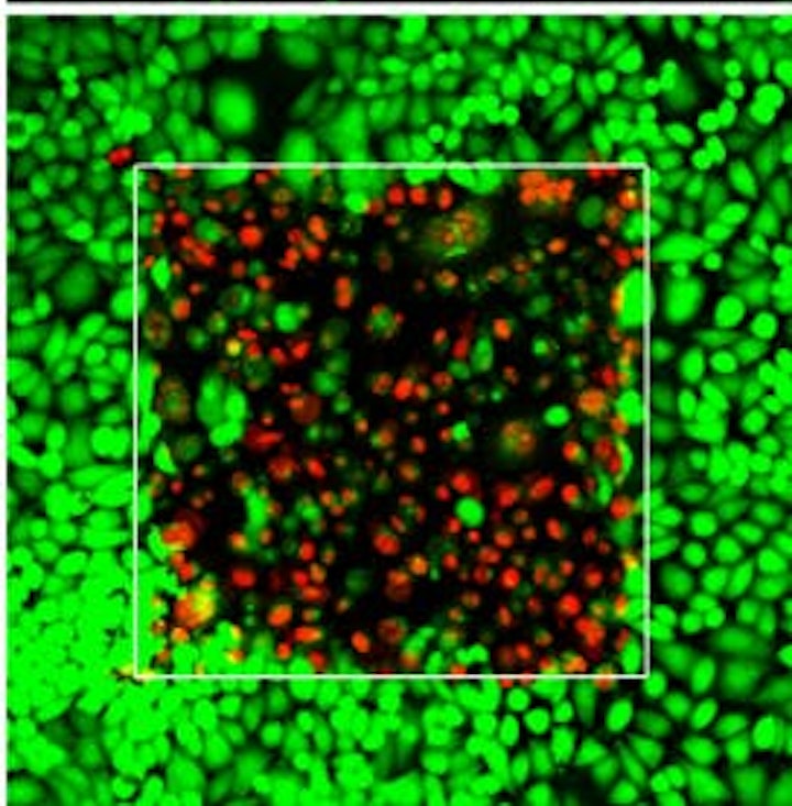 Via single-harmonic generation, anti-cancer photodynamic therapy can happen deep within the body