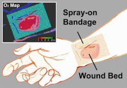 Phosphorescent glow from paint-on &apos;smart&apos; bandage measures tissue oxygenation
