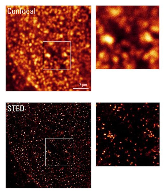 Confocal and STED microscopy are compared.