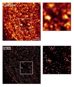 Confocal and STED microscopy are compared. Confocal and STED microscopy are compared.