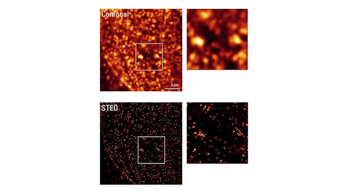 Confocal and STED microscopy are compared.