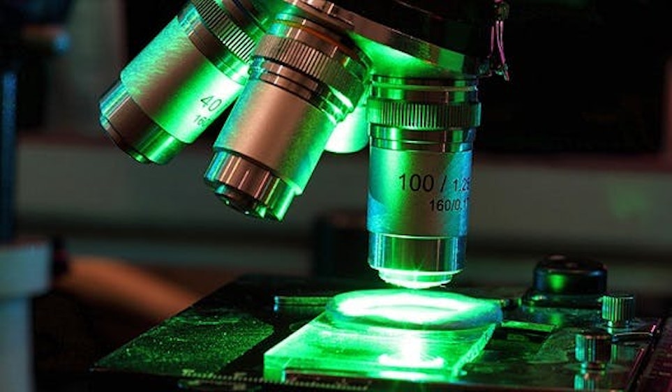 Chaotic cavity laser from Yale could improve imaging quality Laser Focus World