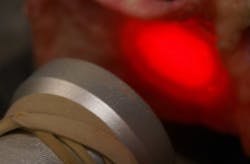 Near-infrared light has been shown to penetrate the skull to aid traumatic brain injury patients. Near-infrared light has been shown to penetrate the skull to aid traumatic brain injury patients.