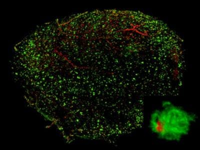 Optical clearing allows a 3D visualization of A&beta; plaques in entire hemispheres of a mouse brain stained with PP-BTA-1 (red) and Alexa488-6E10 (green). The inset shows a high-magnification volume rendering of a representative senile plaque.