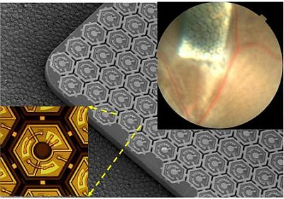 The photovoltaic retinal prosthesis array is shown implanted under the retina in a rat eye. Higher magnification views show the array itself and a single pixel of the implant.