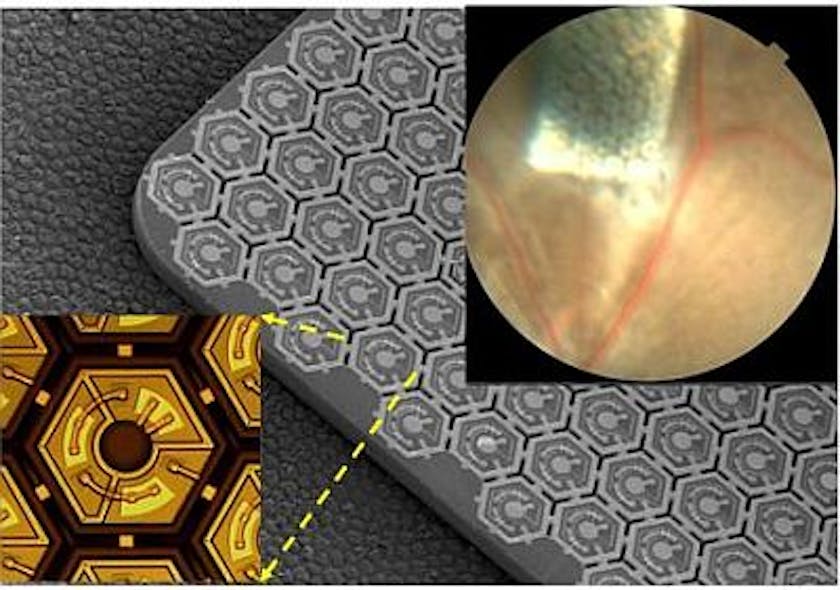 The photovoltaic retinal prosthesis array is shown implanted under the retina in a rat eye. Higher magnification views show the array itself and a single pixel of the implant.