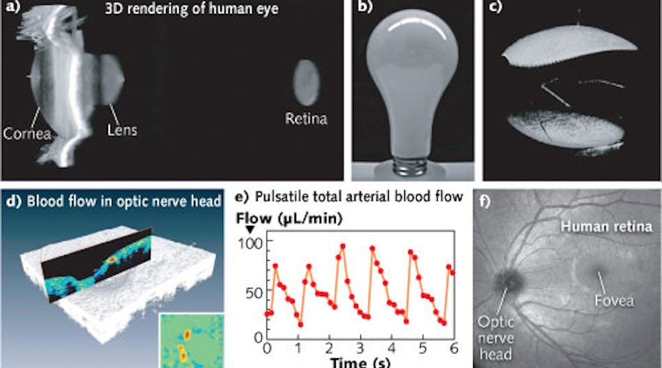 Results of 1060 nm MEMS-VCSEL imaging show (a) 3D OCT data of the anterior eye with an axial eye length measurement to the retina; (b) a light bulb used in OCT imaging experiments; (c) OCT volumetric rendering of the light bulb showing long range imaging with a MEMS-VCSEL; (d) Doppler OCT blood flow measurement in the optic nerve head; and (e) a plot of total arterial blood flow vs. time. Each data point is obtained from a full 3D volumetric analysis, and (f) a wide-field OCT projection image shows 3D data from the human retina obtained at a 1.2 MHz scan rate.