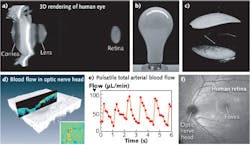Results of 1060 nm MEMS-VCSEL imaging show (a) 3D OCT data of the anterior eye with an axial eye length measurement to the retina; (b) a light bulb used in OCT imaging experiments; (c) OCT volumetric rendering of the light bulb showing long range imaging with a MEMS-VCSEL; (d) Doppler OCT blood flow measurement in the optic nerve head; and (e) a plot of total arterial blood flow vs. time. Each data point is obtained from a full 3D volumetric analysis, and (f) a wide-field OCT projection image shows 3D data from the human retina obtained at a 1.2 MHz scan rate.