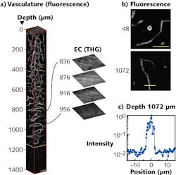 3D reconstructions show three-photon-microscopy images of the brain of a mouse (a). The external capsule extends from 840 to 956 μm below the surface of the brain; frames deeper than 1136 μm (yellow line) were normalized to the frame at 1136 μm and all other frames were individually normalized. Expanded optical sections to the right show third-harmonic-generation images from the external capsule region of the brain. Fluorescence images used in the 3D reconstruction are also shown (b). The fluorescence profile of the line across the vessel in the lower panel (b) is displayed in a semi-logarithmic plot (c). 3D reconstructions show three-photon-microscopy images of the brain of a mouse (a). The external capsule extends from 840 to 956 μm below the surface of the brain; frames deeper than 1136 μm (yellow line) were normalized to the frame at 1136 μm and all other frames were individually normalized. Expanded optical sections to the right show third-harmonic-generation images from the external capsule region of the brain. Fluorescence images used in the 3D reconstruction are also shown (b). The fluorescence profile of the line across the vessel in the lower panel (b) is displayed in a semi-logarithmic plot (c).