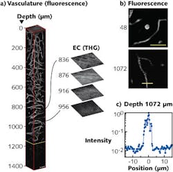 3D reconstructions show three-photon-microscopy images of the brain of a mouse (a). The external capsule extends from 840 to 956 μm below the surface of the brain; frames deeper than 1136 μm (yellow line) were normalized to the frame at 1136 μm and all other frames were individually normalized. Expanded optical sections to the right show third-harmonic-generation images from the external capsule region of the brain. Fluorescence images used in the 3D reconstruction are also shown (b). The fluorescence profile of the line across the vessel in the lower panel (b) is displayed in a semi-logarithmic plot (c). 3D reconstructions show three-photon-microscopy images of the brain of a mouse (a). The external capsule extends from 840 to 956 μm below the surface of the brain; frames deeper than 1136 μm (yellow line) were normalized to the frame at 1136 μm and all other frames were individually normalized. Expanded optical sections to the right show third-harmonic-generation images from the external capsule region of the brain. Fluorescence images used in the 3D reconstruction are also shown (b). The fluorescence profile of the line across the vessel in the lower panel (b) is displayed in a semi-logarithmic plot (c).