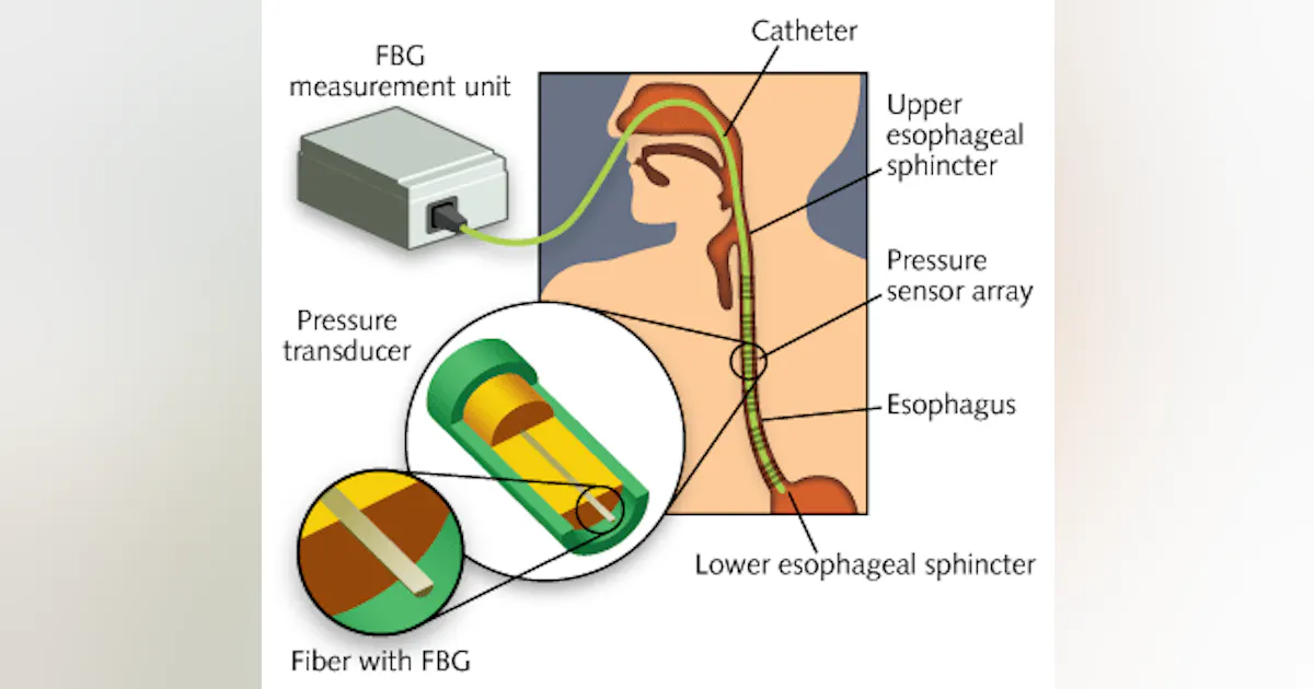 Manometry Tower Draw-tower FBGs aid esophageal manometry | Laser Focus World