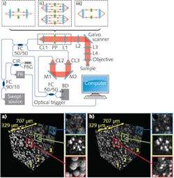 In synthetic-aperture OCT, the insets (i)–(iii) describe the three light propagation paths that constitute three separate optical apertures; L = lens, PP = annular phase plate, CL = collimator, M = mirror, FC = fiber coupler, CIR = circulator, PR = photon receiver, FBG = fiber Bragg grating, and BD = balanced detector. Digital manipulation of the data sets produces extended depth-of-field OCT imaging as evidenced by consistent focus of uniform spheres in an elastomer matrix (b) compared to out-of-focus spheres using standard OCT imaging methods (a). In synthetic-aperture OCT, the insets (i)–(iii) describe the three light propagation paths that constitute three separate optical apertures; L = lens, PP = annular phase plate, CL = collimator, M = mirror, FC = fiber coupler, CIR = circulator, PR = photon receiver, FBG = fiber Bragg grating, and BD = balanced detector. Digital manipulation of the data sets produces extended depth-of-field OCT imaging as evidenced by consistent focus of uniform spheres in an elastomer matrix (b) compared to out-of-focus spheres using standard OCT imaging methods (a).