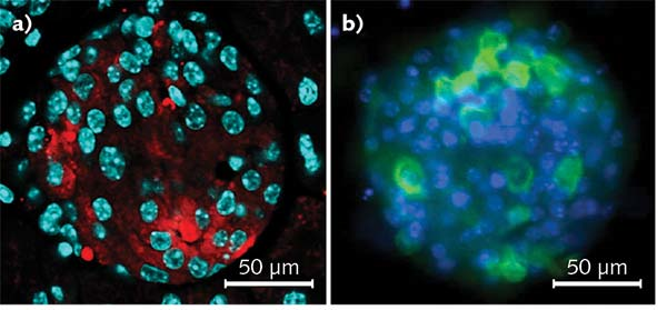 FIGURE 1. Investigating the pancreatic islet cells in mouse. The Olympus FV10i confocal microscope with 60x oil objective enables visualization of insulin-producing &beta;-cells within regions of the pancreas called islets of Langerhans, including a section staining for insulin (red), with nuclei in cyan (a); and islet cells in culture, with insulin (green) and nuclei stained in blue (b).